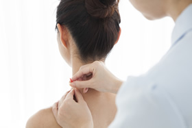 鍼灸で肩こり改善